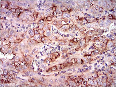 Валидация AntibodySystem RHD46601 (1588)