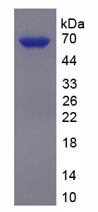 62485
