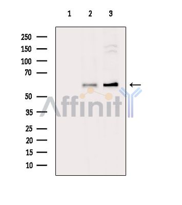 Валидация Affinity DF14164 - 9974
