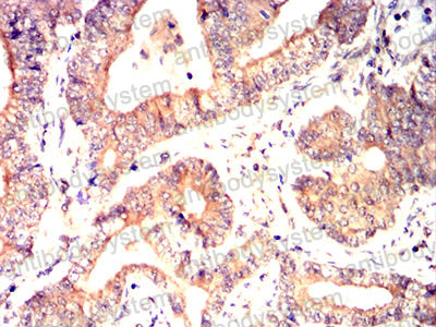 Валидация AntibodySystem RHN05102 (3779)