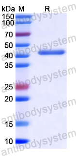 YZZ01001, SDS-PAGE