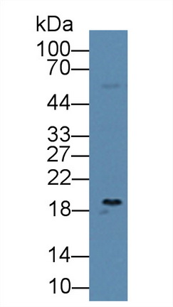 12657