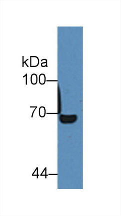 12425