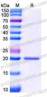 YHH88301, SDS-PAGE