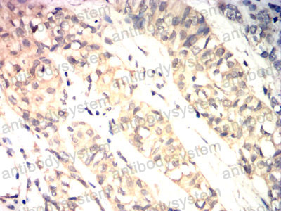Валидация AntibodySystem RHN98302 (4030)