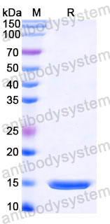 Валидация SDS-PAGE - AntibodySystem RVV03303