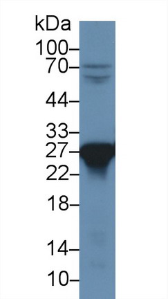 9595