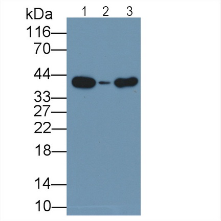 51123