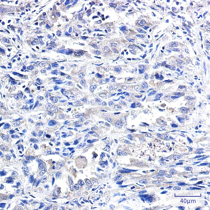 Валидация AntibodySystem RHC84402
