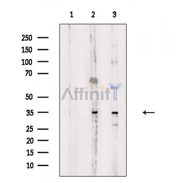 Валидация Affinity DF8701 - 20689