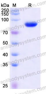 AHG17601, SDS-PAGE