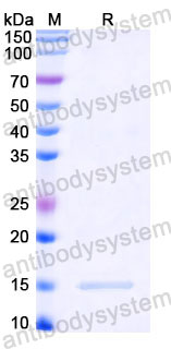Валидация SDS-PAGE - AntibodySystem RVV02824