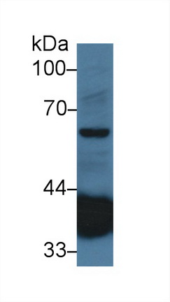14273