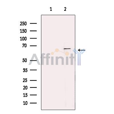 Валидация Affinity DF13745 - 9396