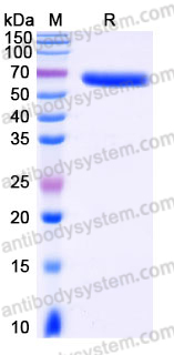 EHJ21701, SDS-PAGE