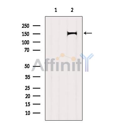 Валидация Affinity AF6192 - 3420