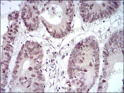 Валидация AntibodySystem RHD24102