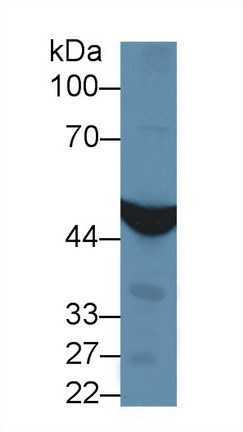 14074