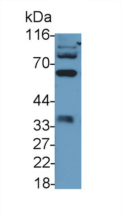 39875