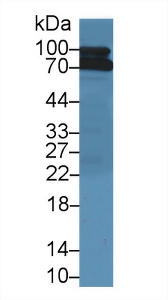 13864