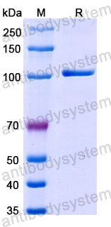 Валидация SDS-PAGE - AntibodySystem DHJ04201