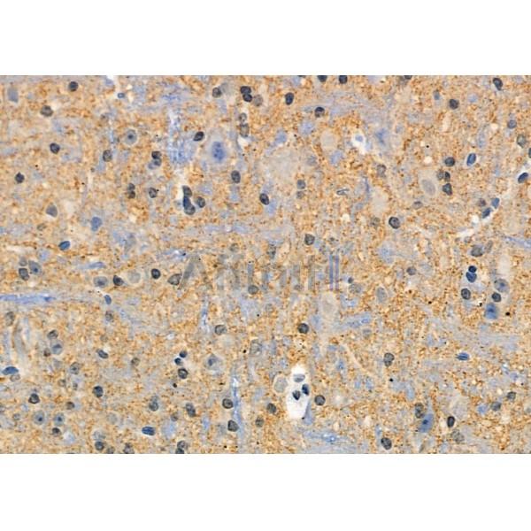 Валидация Affinity AF6201 - 3433