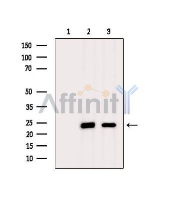 Валидация Affinity DF15661 - 12104