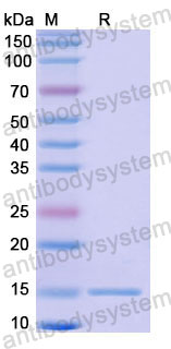 Валидация SDS-PAGE - AntibodySystem RHD03101