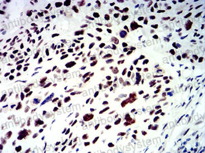 Валидация AntibodySystem RHD79202 (1820)