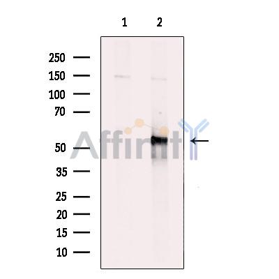 Валидация Affinity DF10365 - 5989