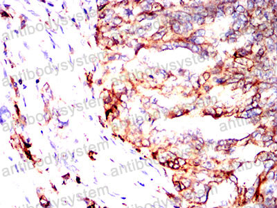 Валидация AntibodySystem RHM01701 (3765)