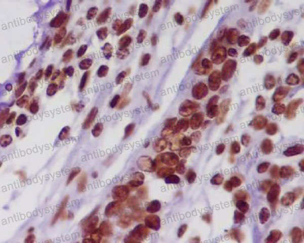 Валидация AntibodySystem RHC11302