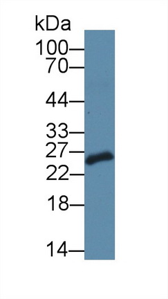 12796
