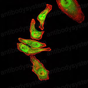 Валидация IF - AntibodySystem RHF53503 (1044)