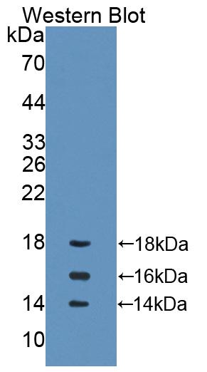 38771