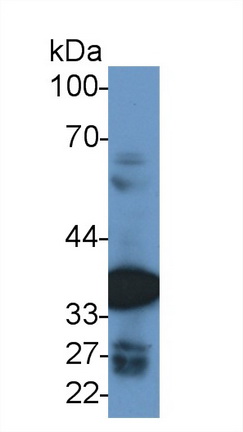 14812
