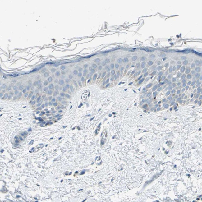 Валидация AssayVector ARM2674(5034)