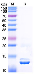 EHB93901, SDS-PAGE
