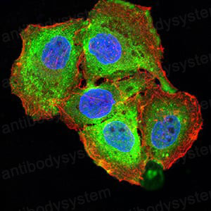 Валидация IF - AntibodySystem RHJ85301