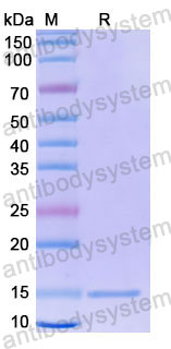 Валидация SDS-PAGE - AntibodySystem RHE48301