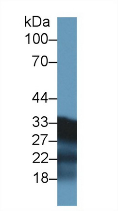 14504