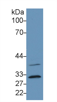 17831