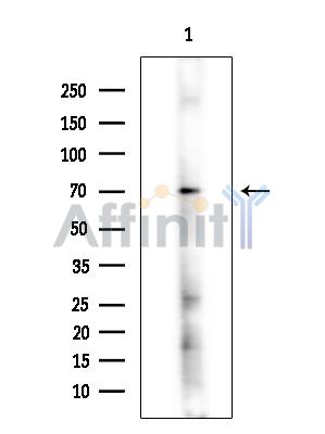 Валидация Affinity DF14889 - 11039