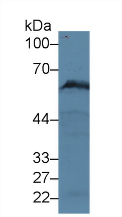 13987