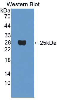 57312