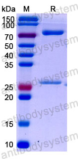 Валидация SDS-PAGE - AntibodySystem DHD12605