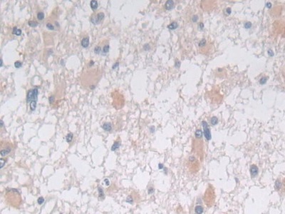 10555