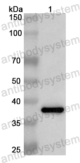 Валидация AntibodySystem PHB74201