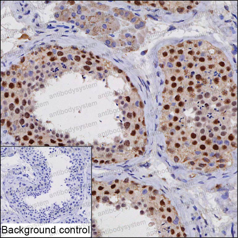 Валидация AntibodySystem RHP09901