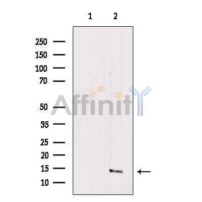 Валидация Affinity DF10094 - 5587